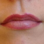 Usta przed pigmentacją i po wygojeniu