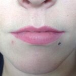 Usta przed zabiegami/po makijażu permanentnym/dodatkowo powiększone kwasem hialuronowym